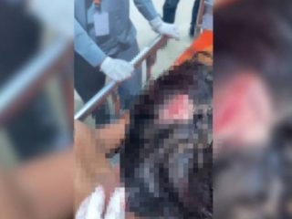 Anak Diduga Dianiaya di Batuan, Keluarga Tempuh Jalur Hukum
